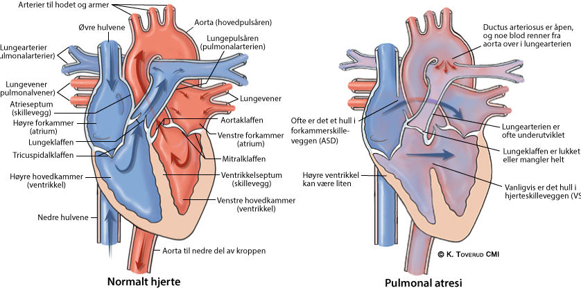 Hjertets anatomiske oppbygning